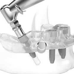 cirurgia-guiada-implante-dentário